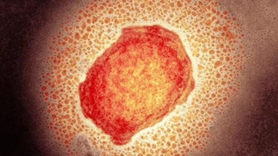 Partícula do vírus da varíola dos macacos; primeiro caso foi confirmado no Brasil - SCIENCE PHOTO LIBRARY
