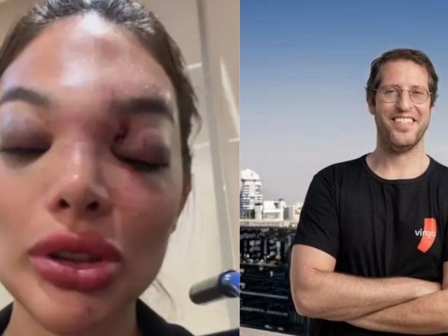 Imagem ilustrativa sobre Empresário oferece Pix ao dentista para 'sumir' após agressão