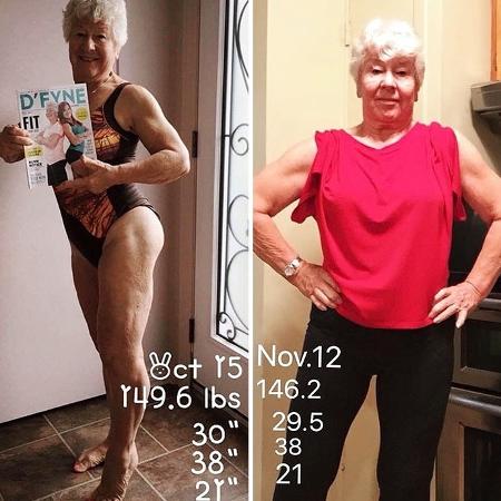 Mulher de 73 anos perde 62 quilos em Ontário, no Canadá - Reprodução/Instagram