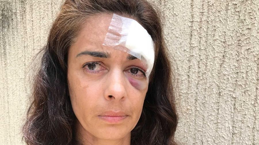 Motorista foi agredida em confusão após confusão com passageiras - Daniela Mallmann