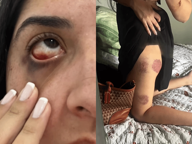 Justiça decreta prisão de homem suspeito de esfaquear ex-namorada
