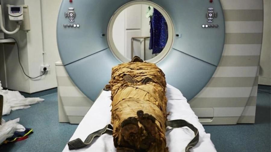 Cientistias britânicos descobrem voz de múmia - Reprodução/Leeds Teaching Hospitals/Leeds Museums and Galleries.