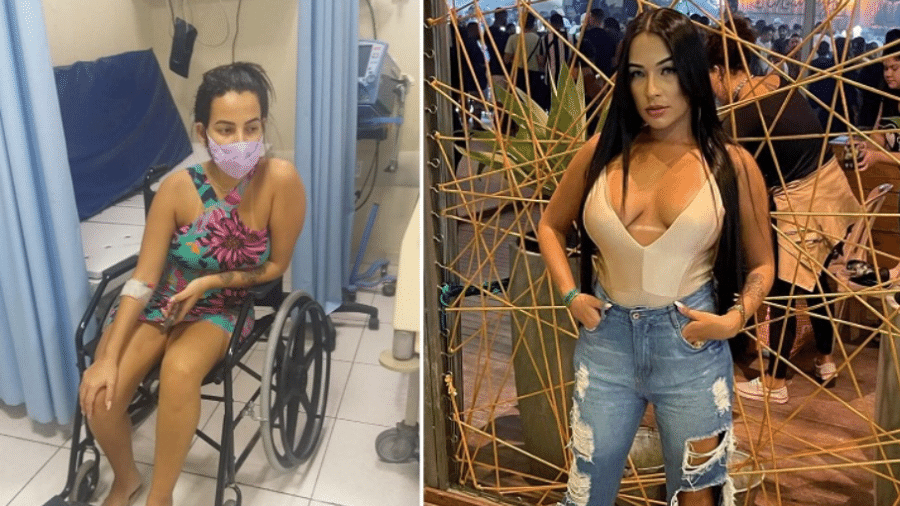 Daiana França, de 28 anos, realizou intervenção na barriga e preenchimento no bumbum. Dias após o procedimento, precisou ser internada com infecção generalizada - Arquivo Pessoal e Reprodução/Instagram