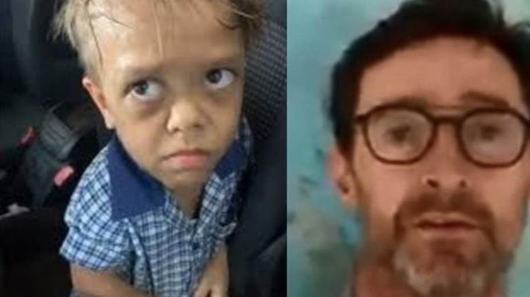 Quaden tem nanismo | Viral de menino que sofre bullying gera comoção e apoio global