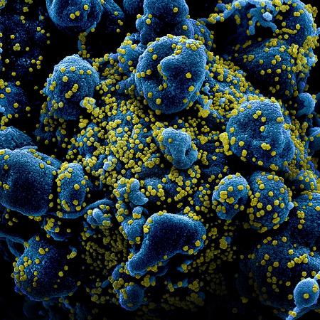 Vírus Sars-COV-2 (em amarelo) infectam células humanas, que replicam material genético e morrem - NIAID