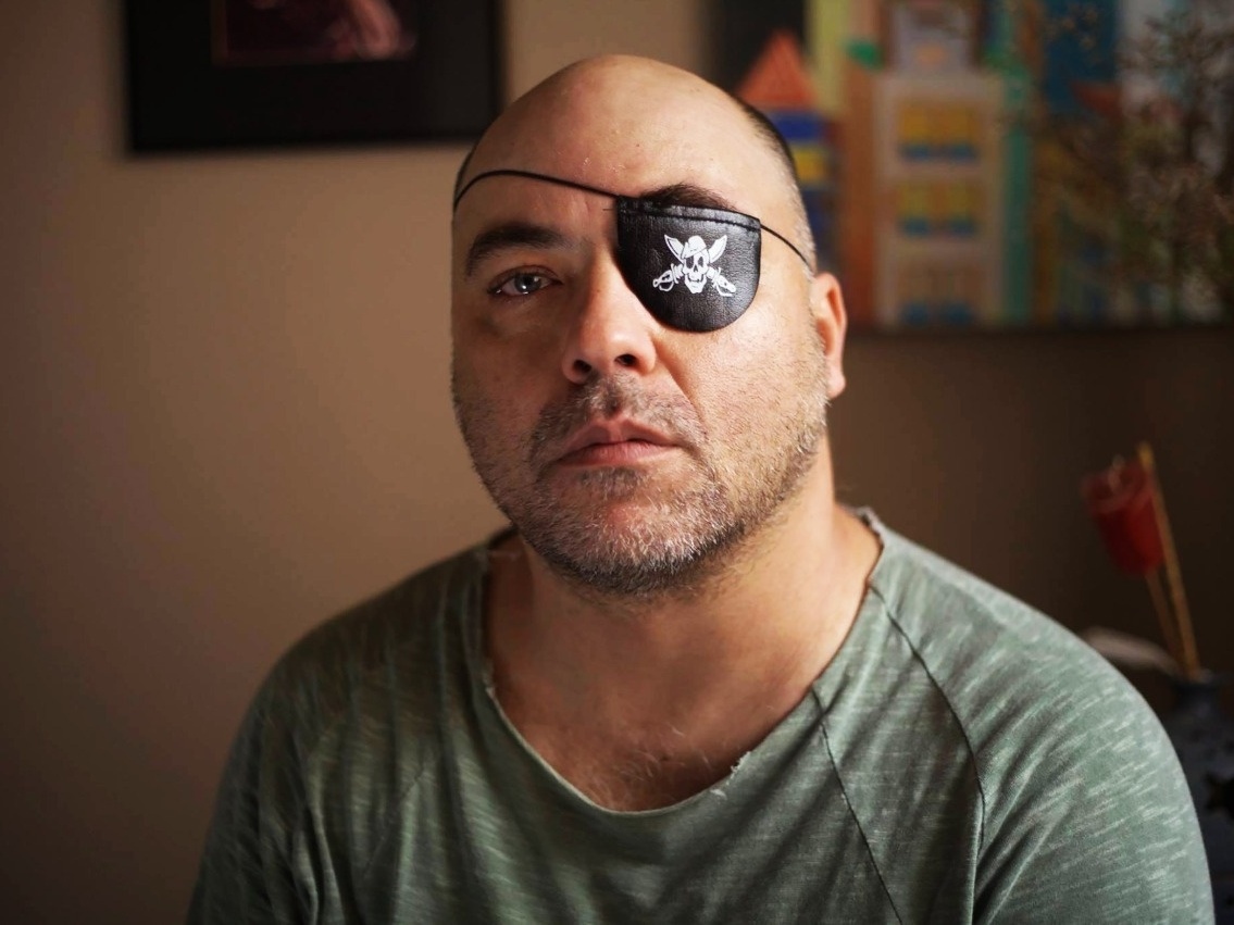 Após 21 anos, fotógrafo atingido no olho pela PM tenta reparação no STF