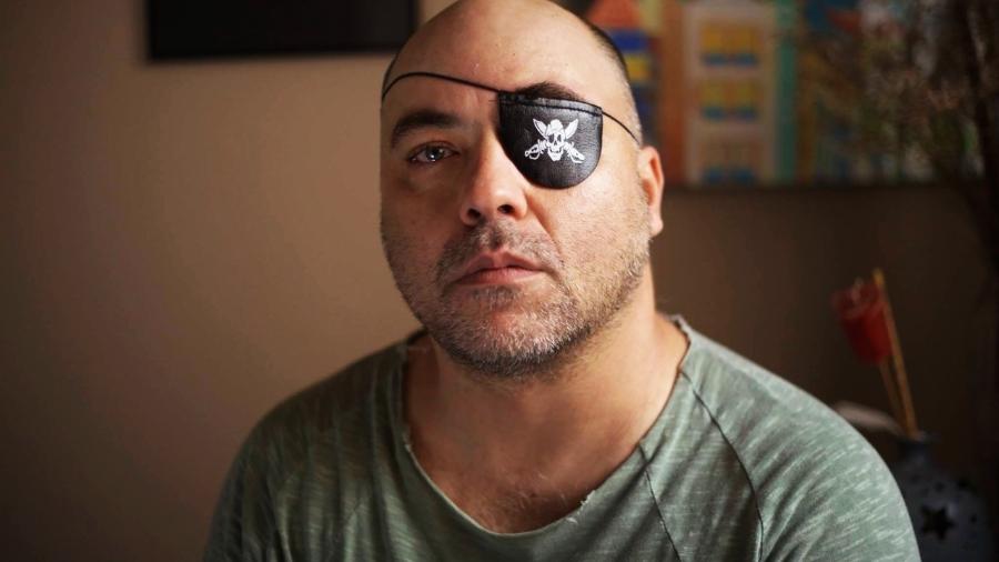 Fotógrafo Alex da Silveira, ferido por uma bala de borracha durante protesto em 2000 - Sergio Silva