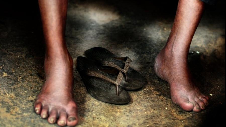 Mulheres e a população negra são mais afetadas pela piora das condições de vida no país - Arnaldo Carvalho/Getty Images