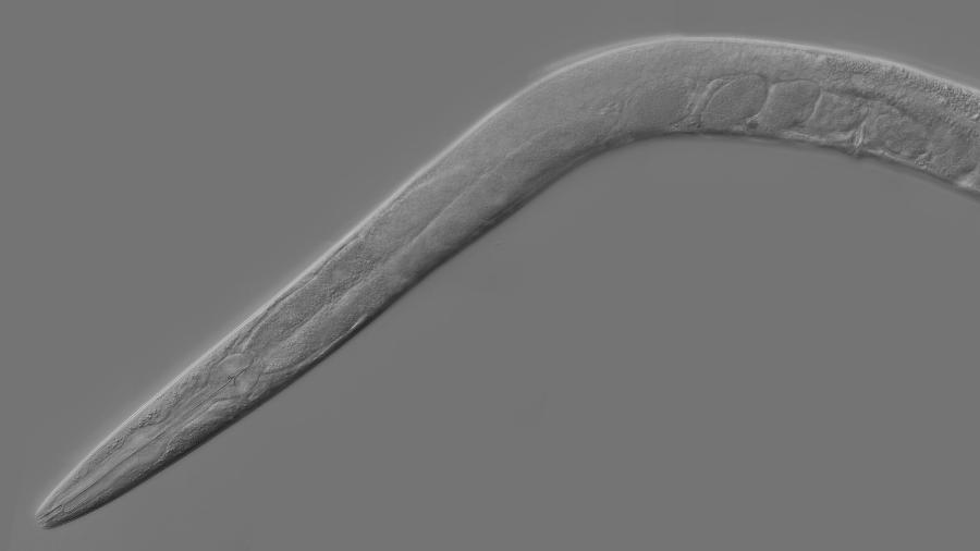 Estudo em vermes abre nova possibilidade para ampliar nossa expectativa de vida - Wikimedia Commons