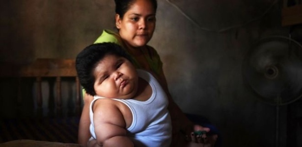 O tratamento de bebês obesos é nutricional - AFP