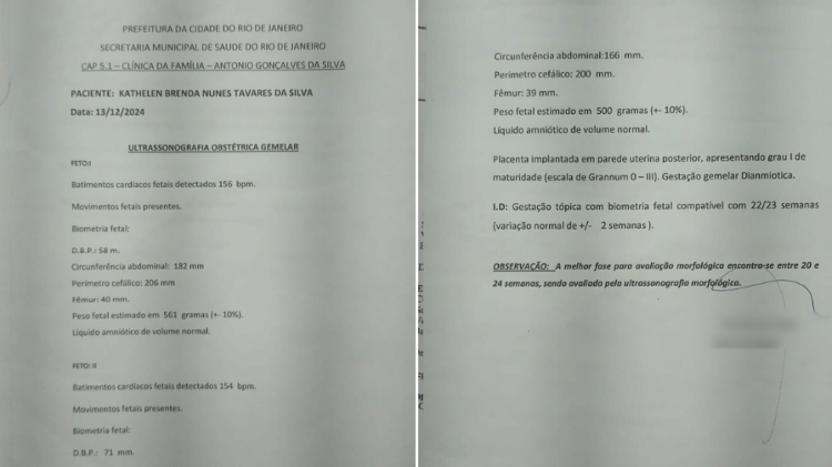 Exame de dezembro compartilhado pela mulher indicava que havia dois fetos Exame de dezembro compartilhado pela mulher indicava que havia dois fetos