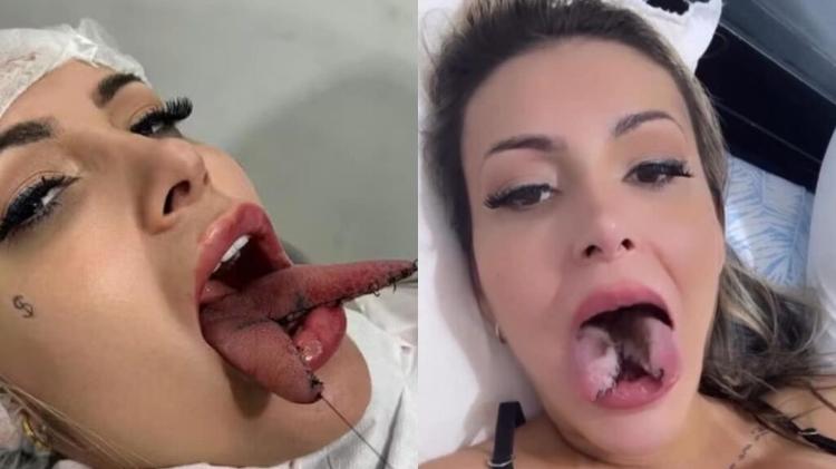 Andressa Urach aparece com língua cortada ao meio e choca público