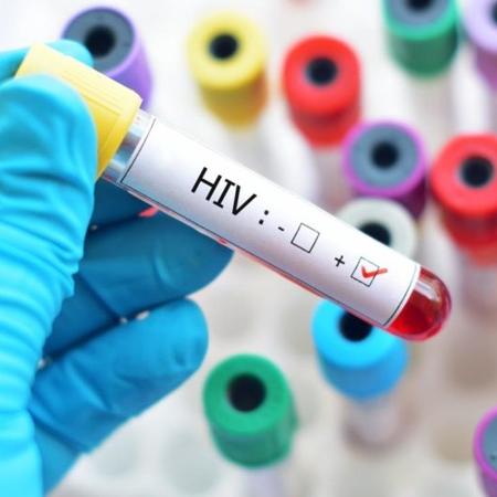 HIV (Foto Ilustrativa)