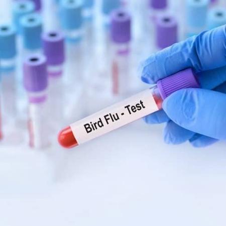 Gripe aviária: OMS confirma primeira morte por variante H5N2 