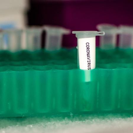 O anticorpo conseguiu neutralizar uma cepa do vírus - Foto: iStock/ Manjurul