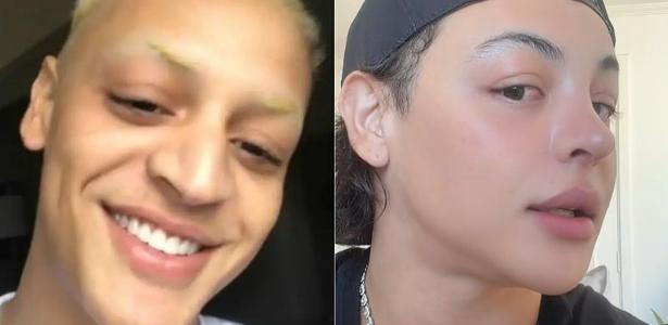 Pabllo Vittar mostrou resultado de sua 3ª rinoplastia - undefined