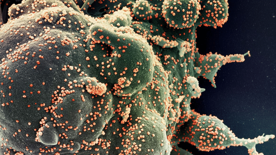 Variante Ômicron é muito transmissível - Foto: Instituto Nacional de Alergia e Doenças Infecciosas
