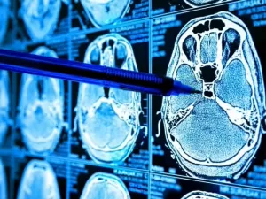 Modelo de IA pode detectar um tumor cerebral cancerígeno em 10 segundos