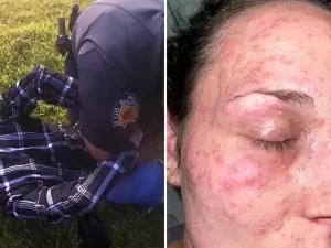 Mulher processa a Polícia após ser algemada com a cara em formigueiro: "Gritava"