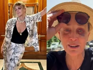 Olho roxo de Sharon Stone em foto preocupa fãs, e artista se pronuncia