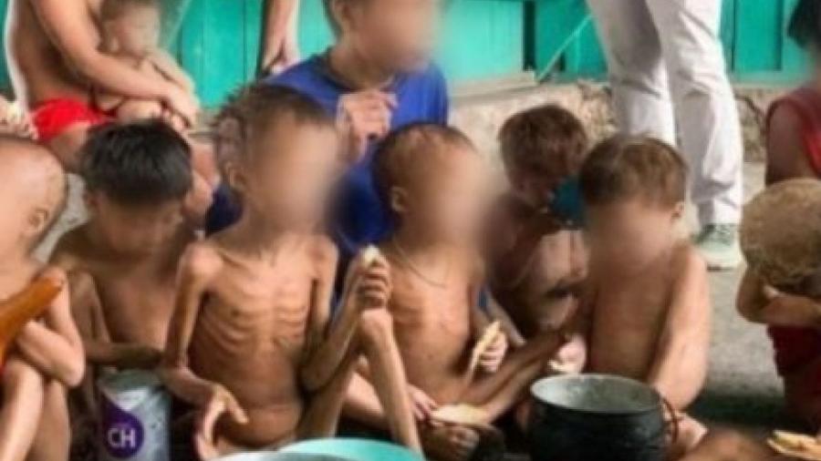  Criança com desnutrição grave morre em Terra Yanomami, diz líder  -  O Antagonista 