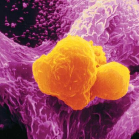 Macrófagos são células que defendem o corpo de invasores - 