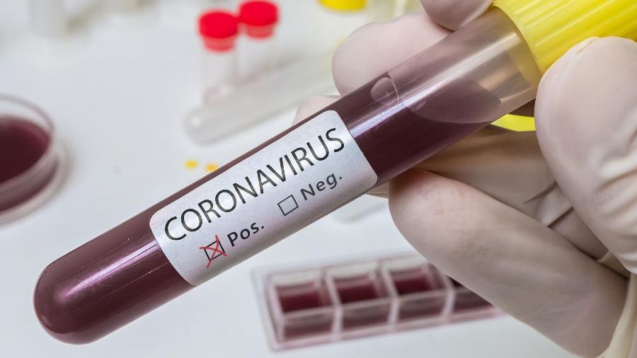 Califórnia confirma segundo caso de origem desconhecida do novo coronavírus - iStock/vchal