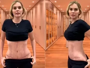 Bárbara Evans mostra cicatriz após plásticas nos seios e barriga: "Ainda estou roxa"