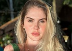 Bárbara Evans faz alerta na web após ser diagnosticada com melanoma - Reprodução/Instagram