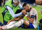 Mbappé tem lesão no nariz e chama atenção dos torcedores; veja - Getty Images