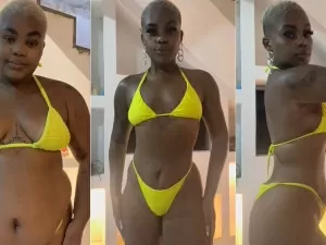 Influencer viraliza ao mostrar corpo 1 ano após bariátrica: "Menos 45kg"