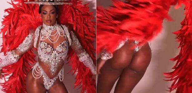 Marvvila contou que fez procedimento no bumbum antes de desfile na Sapucaí - undefined