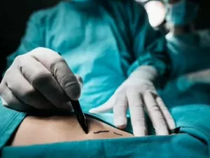 Especialista revela popularidade do Brasil em cirurgias plásticas: 'Destinos mais procurados'