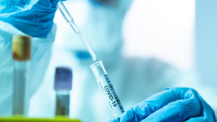 O Brasil é o primeiro país fora do Reino Unido a iniciar testes com a vacina desenvolvida pela Universidade de Oxford - Selimaksan