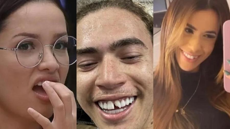 Diversos famosos já passaram por situações envolvendo seus dentes, na maioria das vezes quebrados - Reprodução/ Instagram