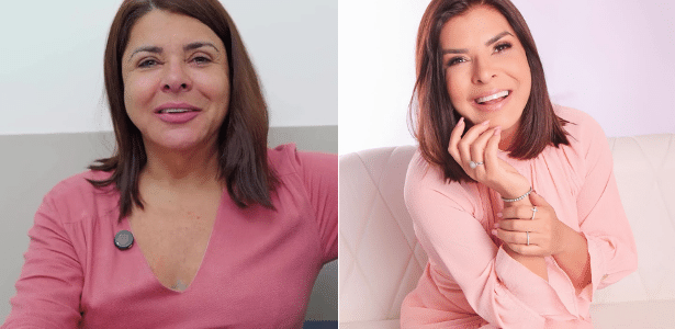 Cover image for Mara Maravilha mostra antes e depois de facelifting: 'Estou repaginada'