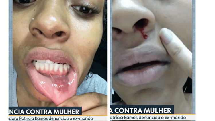 Patrícia Ramos divulgou imagens de supostas agressões de Diogo