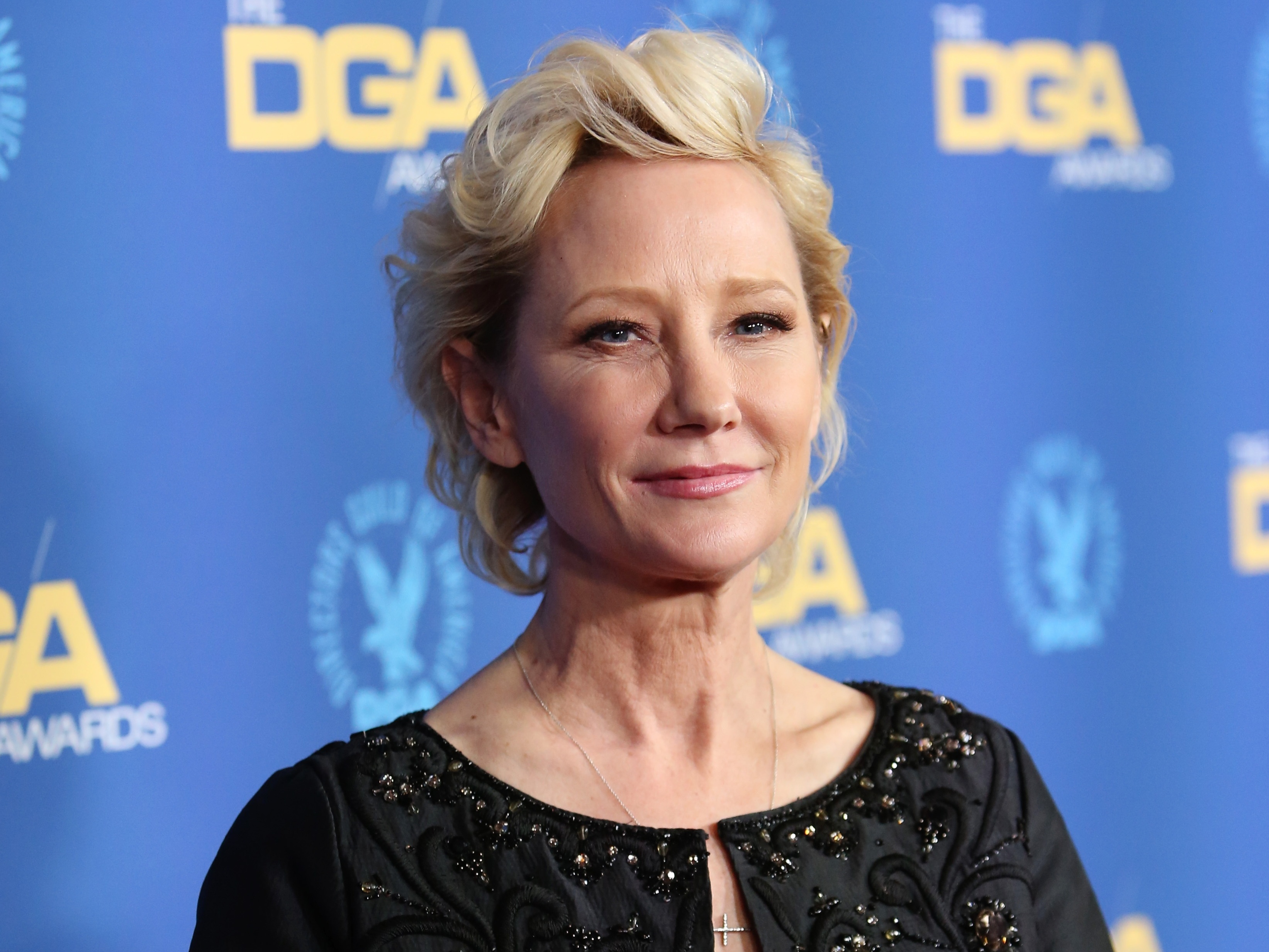 Anne Heche: quem &eacute; a atriz em coma ap&oacute;s sofrer acidente