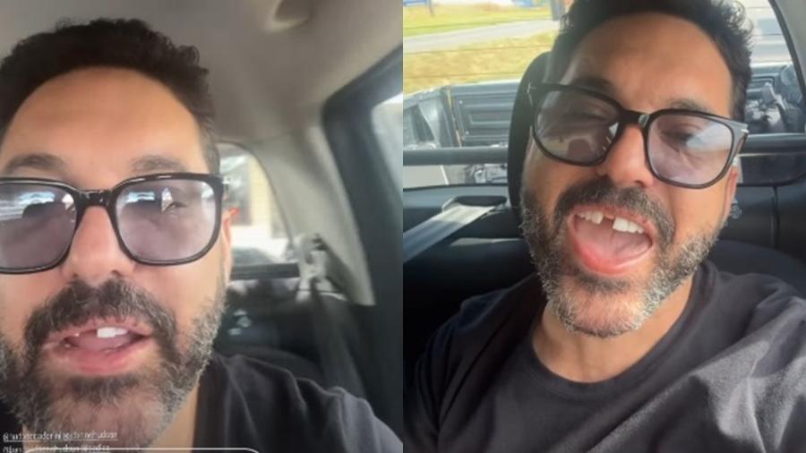 Dupla de Hudson, Edson perde dente antes de show Dupla de Hudson, Edson perde dente antes de show