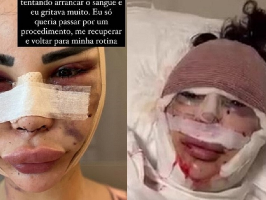 Não, Sofia Vergara não fez cirurgia plástica: 'isso se chama