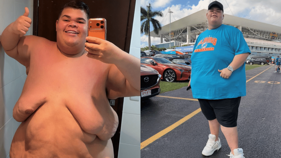 Gordão da XJ mostra antes e depois após perder 115 kg: 'Não foi fácil'