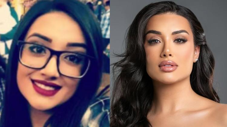 Jordana antes de procedimentos estéticos e em foto mais recente