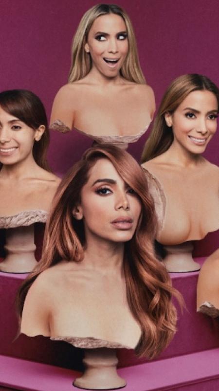 Anitta fala sobre relação com cirurgia plástica: 'gosto de mudar