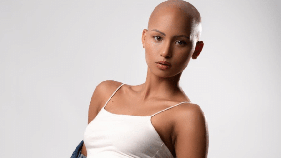 Yas Brito, 22, nunca teve cabelos; após anos de investigação, ela descobriu que tinha alopecia e hoje luta contra preconceito - Reprodução/Instagram 