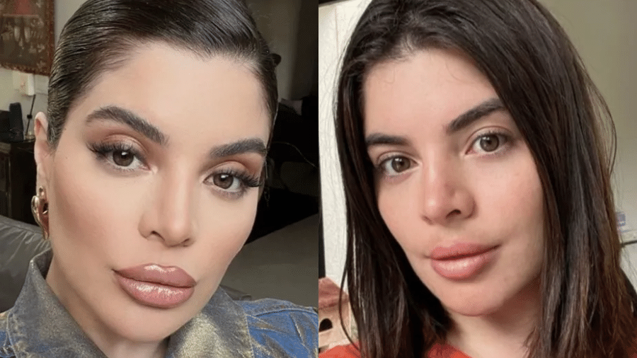 Gkay antes e depois do preenchimento labial - Reprodução/Instagram