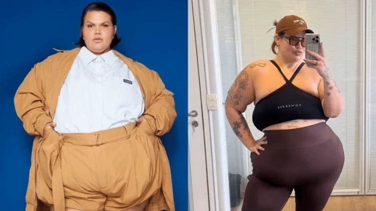 Thais Carla mostra antes e depois de procedimento cirúrgico Thais Carla mostra antes e depois de procedimento cirúrgico