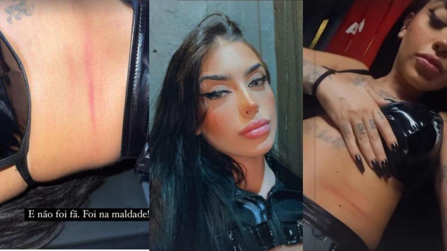 Mirella mostra marcas de agressão pelo corpo - Reprodução/Instagram 