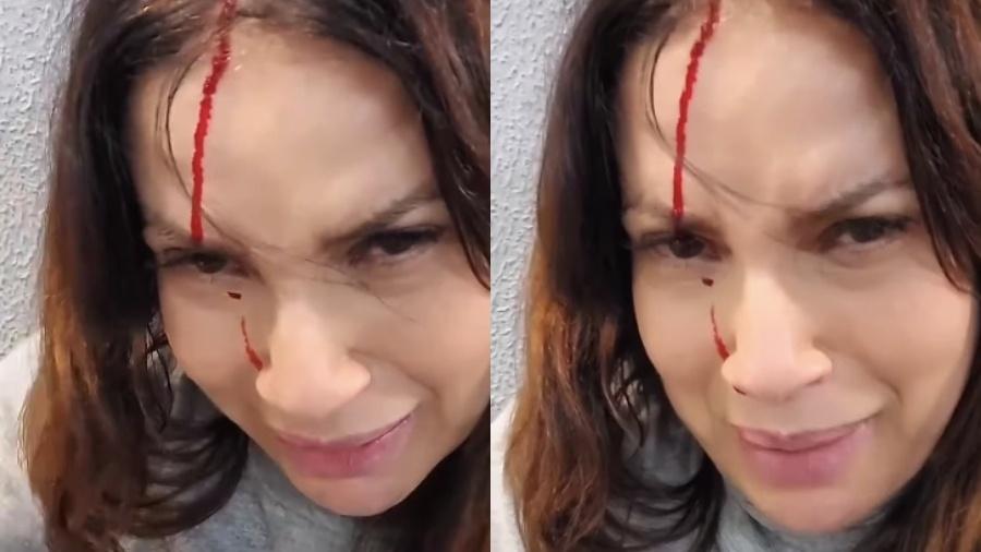 Isadora Ribeiro aparece sangrando para relatar acidente Isadora Ribeiro aparece sangrando para relatar acidente