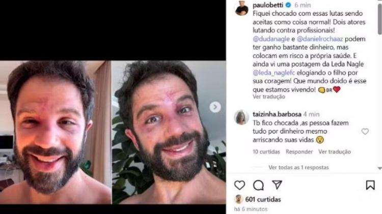 Paulo Betti critica participação de Duda Nagle e Daniel Rocha em lutas Paulo Betti critica participação de Duda Nagle e Daniel Rocha em lutas