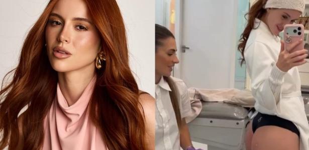 Esposa de Richarlison mostra antes e depois de harmonização glútea e facial